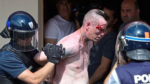 Четверо пострадавших находятся в тяжелом состоянии Четверо пострадавших находятся в тяжелом состоянии